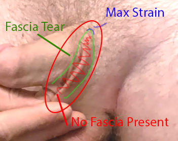 area-of-interest-2-diagram